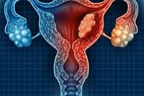 Ghi nhận khoảng 6.200 ca ung thư liên quan đến HPV mỗi năm