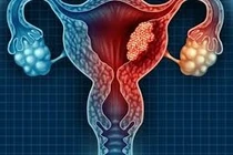 Ghi nhận khoảng 6.200 ca ung thư liên quan đến HPV mỗi năm