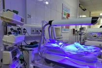 Cứu sống bé sơ sinh mắc mềm khí quản bẩm sinh hiếm gặp tại Thanh Hóa