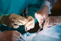 Phẫu thuật thành công cho người phụ nữ mắc khối u ác tính cột sống hiếm gặp 