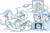 Can thiệp thành công ca thông tim bào thai thứ 12 