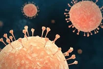 Bệnh quai bị dễ lây lan, có thể gây biến chứng nguy hiểm