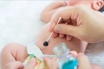 Trẻ sơ sinh 10 ngày tuổi ở Đồng Nai nguy kịch vì uốn ván sơ sinh