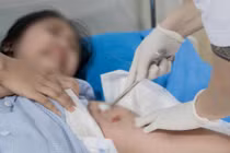 Bé gái 12 tuổi ở Phú Thọ bị chó cắn phải nhập viện