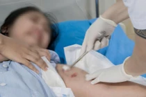 Bé gái 12 tuổi ở Phú Thọ bị chó cắn phải nhập viện