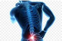 Nhóm thực phẩm người thoát vị đĩa đệm cần tránh