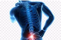 Nhóm thực phẩm người thoát vị đĩa đệm cần tránh