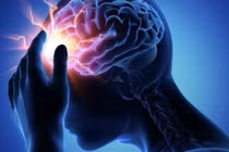 Phẫu thuật giúp người phụ nữ thoát khỏi nỗi đau nửa đầu kéo dài 20 năm