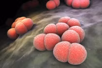 Nguy cơ dịch bệnh não mô cầu tăng cao trong mùa lạnh 