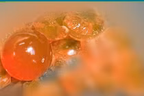 Nuốt hạt nhựa nở, bé 14 tháng thoát khỏi cắt ruột nhờ phẫu thuật kịp thời