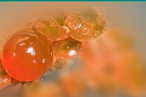 Nuốt hạt nhựa nở, bé 14 tháng thoát khỏi cắt ruột nhờ phẫu thuật kịp thời