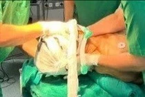 Người đàn ông bị trật đốt sống cổ phức tạp