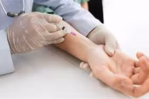 Nguy cơ biến chứng nặng sau tiêm corticosteroid điều trị hội chứng ống cổ tay