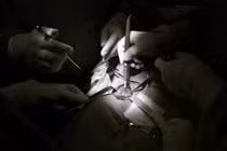 Phát hiện ung thư tuyến giáp qua khám sức khỏe định kỳ