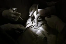 Phát hiện ung thư tuyến giáp qua khám sức khỏe định kỳ