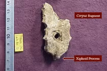 Phát hiện thi hài cổ đại với lỗ tròn kỳ lạ trên đảo Thasos