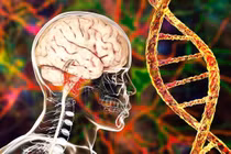 Sốc: Dị tật bẩm sinh não có thể do ADN người Neanderthal