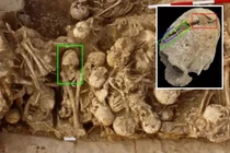 "Nội soi" hộp sọ 6.200 tuổi, sốc nặng cái chết của chủ nhân