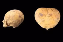  Phát hiện hộp sọ kỳ lạ nghi ngoài hành tinh ở Argentina