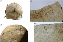 Hộp sọ hé lộ sự tàn bạo La Mã với kẻ thù