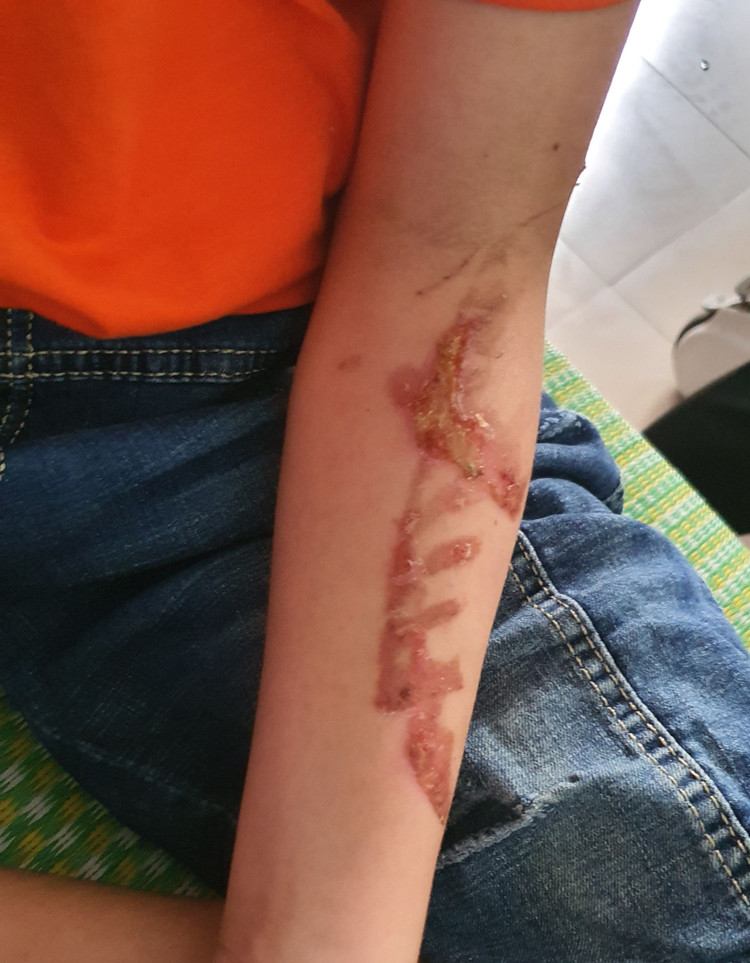 Nữ chủ quán bánh xèo đánh nhân viên bằng chày đá, dao, bàn chải sắt - 4