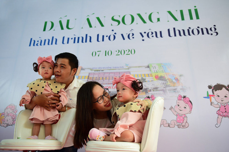 Hai bé Song Nhi xuất viện sau gần 3 tháng mổ tách dính thành công