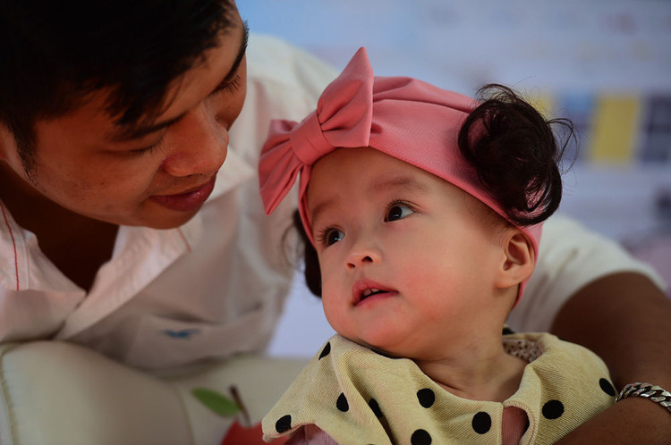 Hai bé Song Nhi xuất viện sau gần 3 tháng mổ tách dính thành công