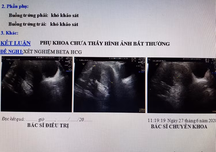 Quảng Nam: Vác bụng bầu đi đẻ, đến viện bác sĩ phát hiện không có thai - 1