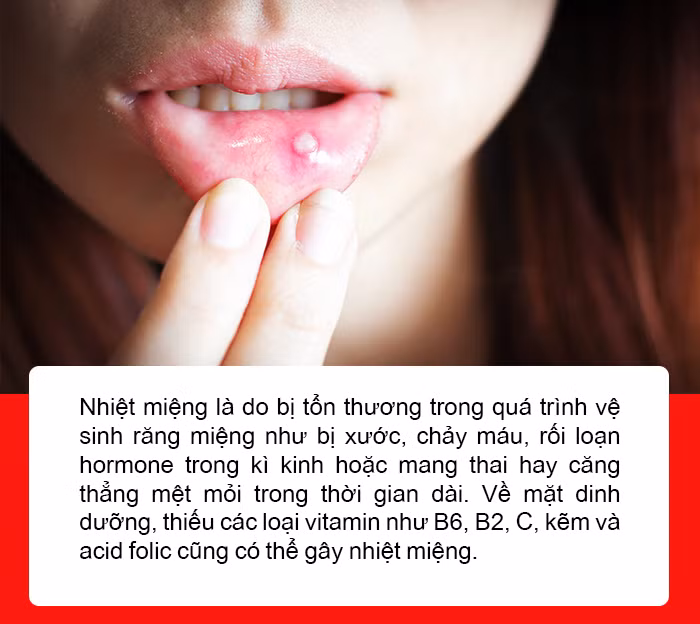 Vì sao 1 số người bị ợ nóng, nổi mụn, nhiệt miệng sau khi ăn thực phẩm? ảnh 4