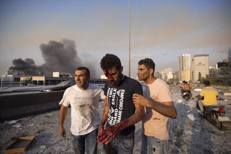 no lon o Beirut anh 9