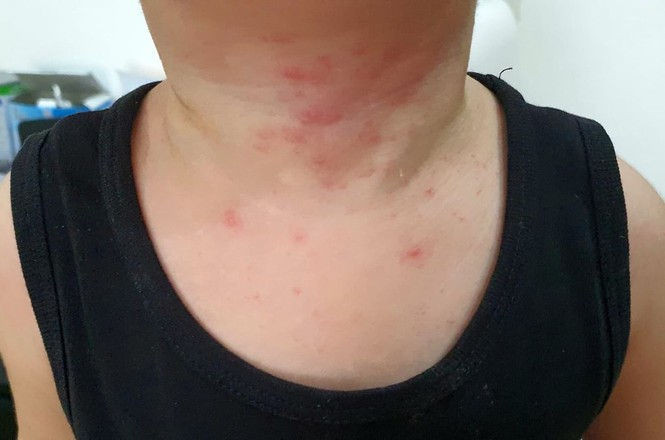 Ban quản lý tự ý pha thuốc diệt khuẩn, cư dân chung cư bị dị ứng? - ảnh 1