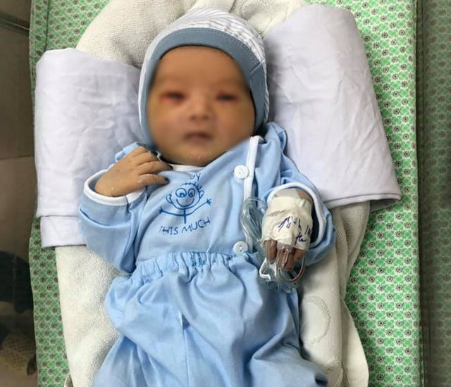 Bé sơ sinh bị bỏ rơi dưới hố ga bị nhiễm trùng máu nặng, phải thở máy - 2