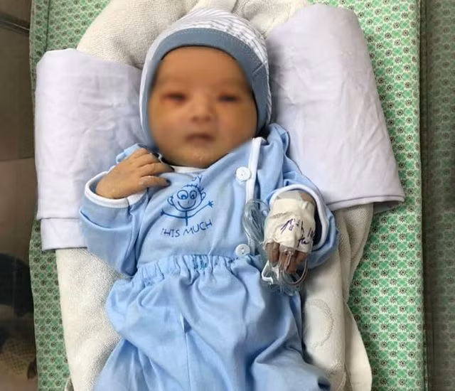 Bé sơ sinh bị bỏ rơi dưới hố ga bị nhiễm trùng máu nặng, phải thở máy - 2