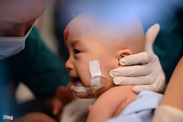 tach song sinh dinh lien anh 2