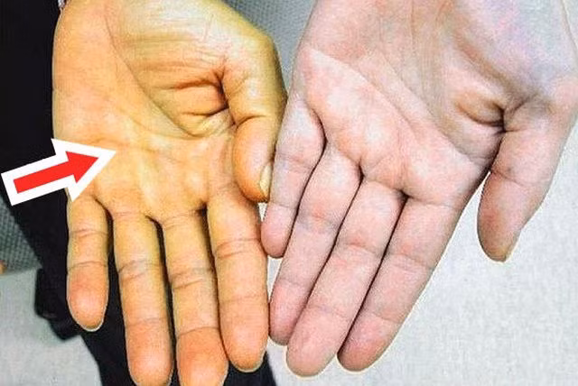 Chế độ ăn uống phản khoa học gây ung thư gan như thế nào? - 4