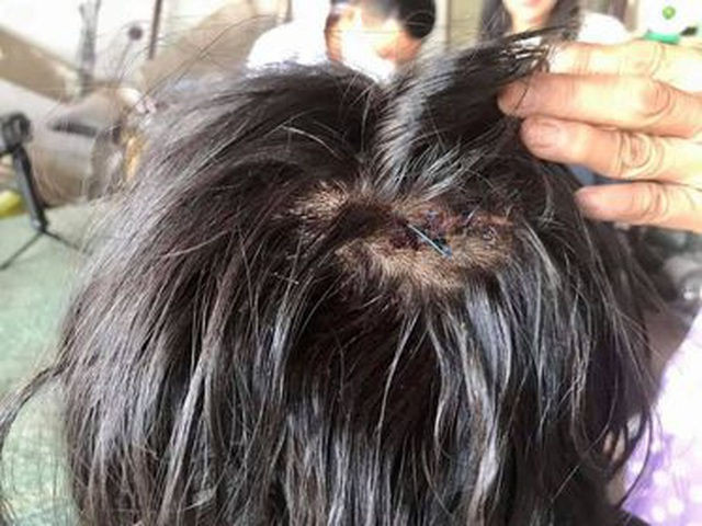 Đã xác định mức độ thương tật của nữ sinh bị đánh sau vụ va chạm giao thông - 1