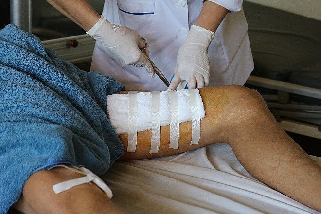 Bình rượu phát nổ, người đàn ông bị đứt cơ chân và động mạch - ảnh 1