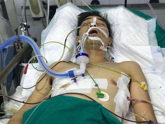 Lai xe GrabBike bi cuop tai san anh 2