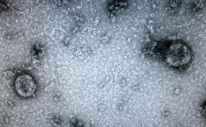 'Virus gay benh Covid-19 o Viet Nam da tien hoa' hinh anh 1 corona_24.jpg