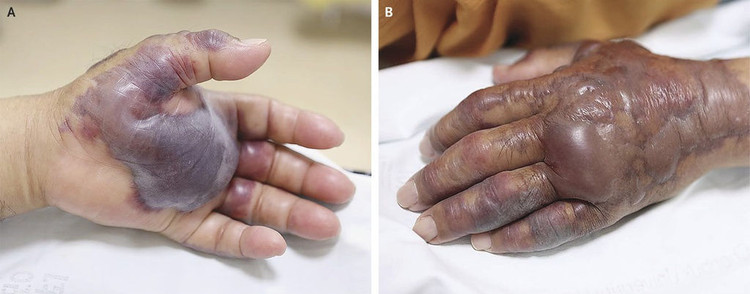 vi khuan trong hau song anh 1