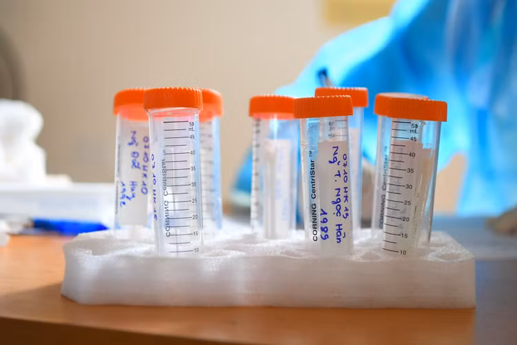 Xet nghiem Covid-19 nguoi dan tro ve tu TP.HCM anh 8