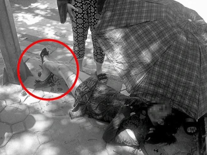 Người phụ nữ bị gãy gập chân vì áo chống nắng cuốn vào bánh xe máy - 1