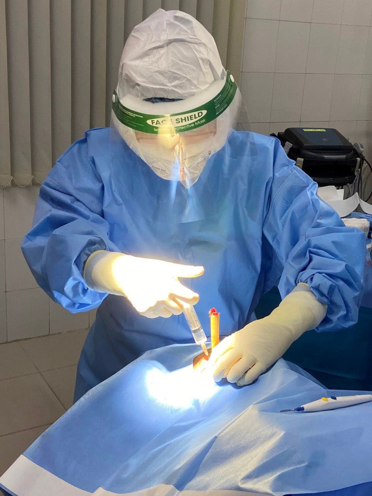 Bệnh nhân bị cây đâm xuyên toàn bộ nhãn cầu, qua đỉnh hốc mắt vào sâu sàn sọ 1cm.