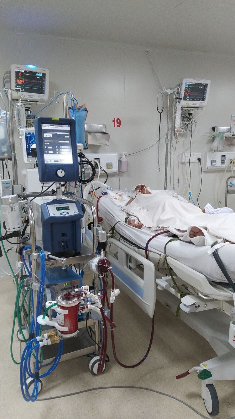 bn-dang-can-thiep-ecmo.jpg