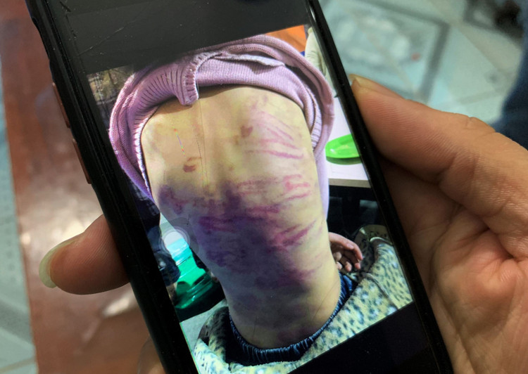 be gai 12 tuoi bi bao hanh anh 1