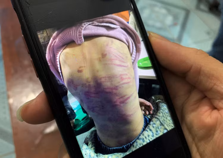 gai 12 tuoi bi bao hanh anh 1