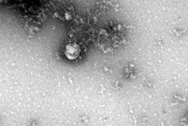 Hinh anh dau tien cua bien chung SARS-CoV-2 o Anh hinh anh