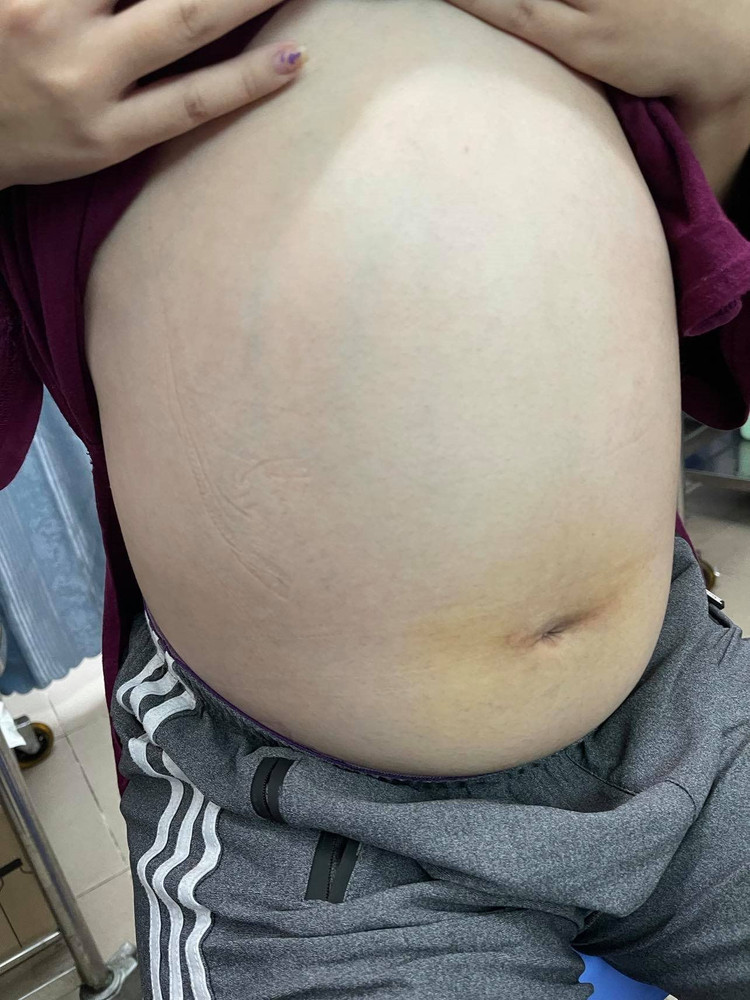 Bệnh lý ung thư phụ khoa, như ung thư buồng trứng, có thể xuất hiện bất cứ lứa tuổi nào.