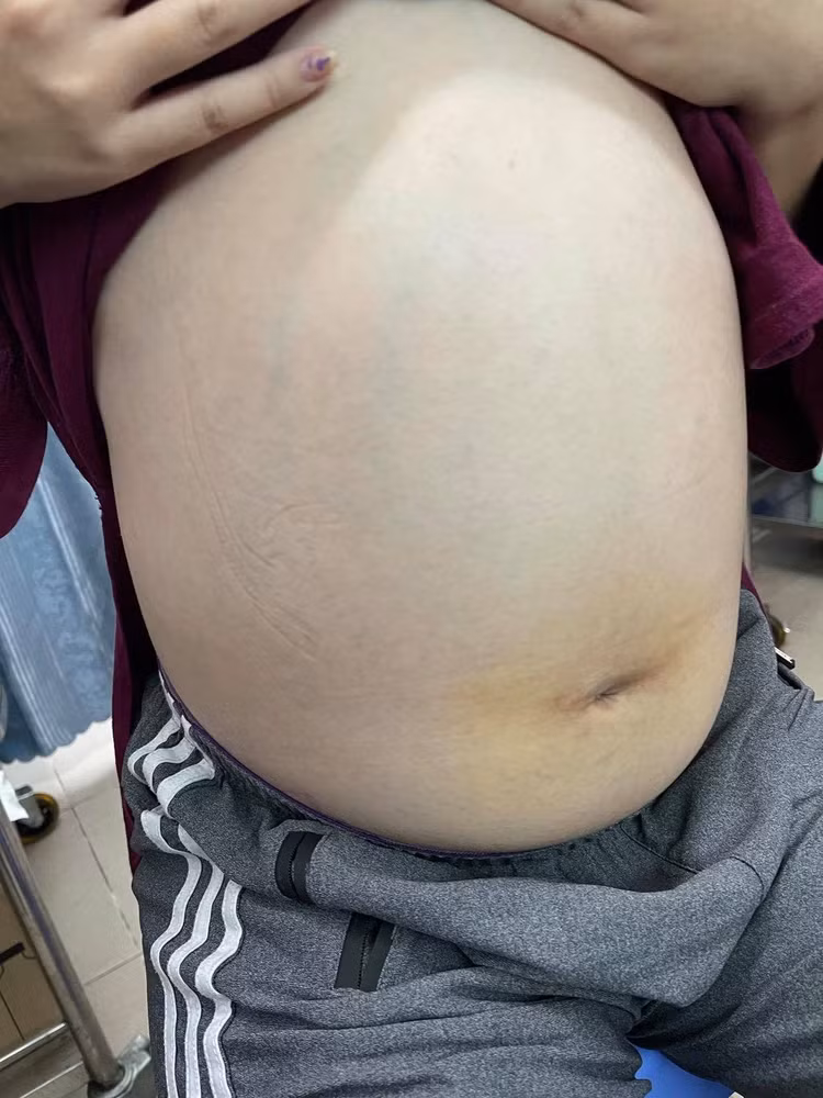 Bệnh lý ung thư phụ khoa, như ung thư buồng trứng, có thể xuất hiện bất cứ lứa tuổi nào.