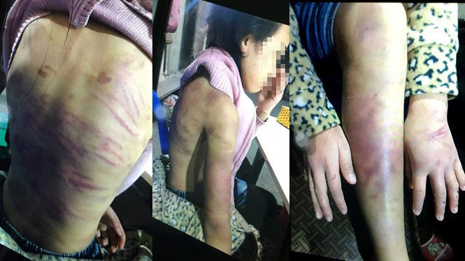 Bé gái bị bạo hành, hiếp dâm tại Hà Nội: Hàng xóm phát hiện mẹ bắt trói, dán mồm con để đánh qua camera - ảnh 2